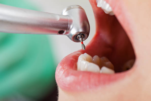 Best Emergency Dentist for Knocked-Out Tooth in Riverside, PA